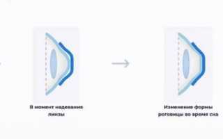 Что такое ночные линзы MoonLens? Ответ здесь