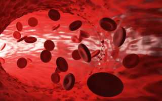 Как понять, что в организме дефицит железа? Признаки и диагностика