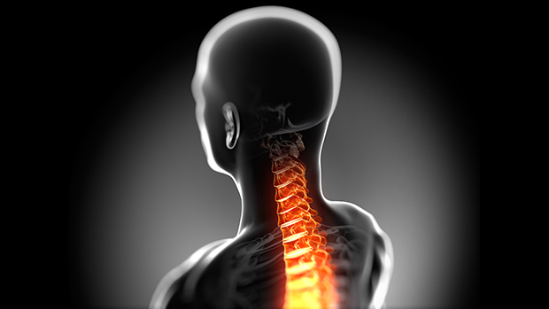 Травмы шейного отдела позвоночника